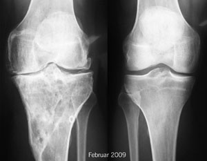 Röntgenbilder Februar 2009 - Klicken für grössere Fassung