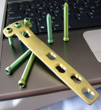 Das Metall... klicken für grössere Fasssung