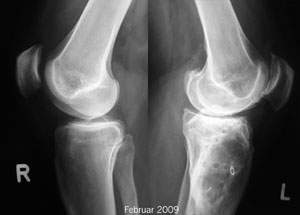 Röntgenbilder Februar 2009 - Klicken für grössere Fassung